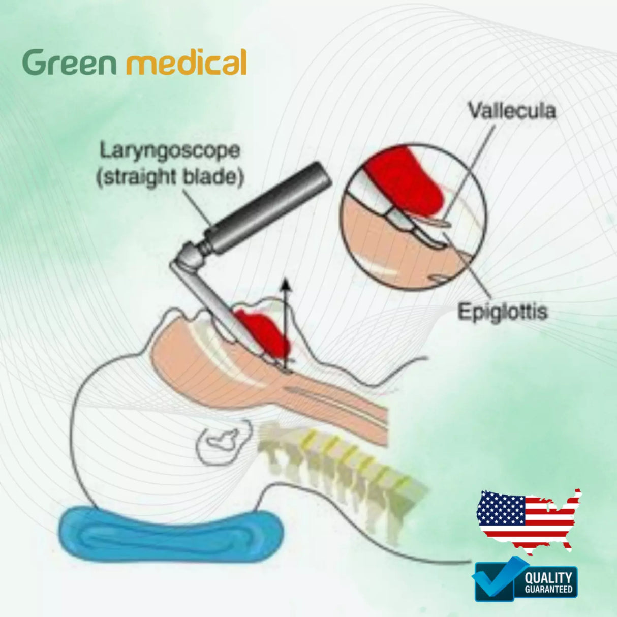 Laryngoscope Set Fiber Optic MACINTOSH MILLER Blades 3 Handle EMT Intubation Kit